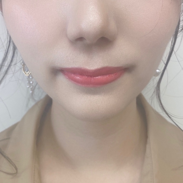 After